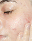 Cleansing Gel
